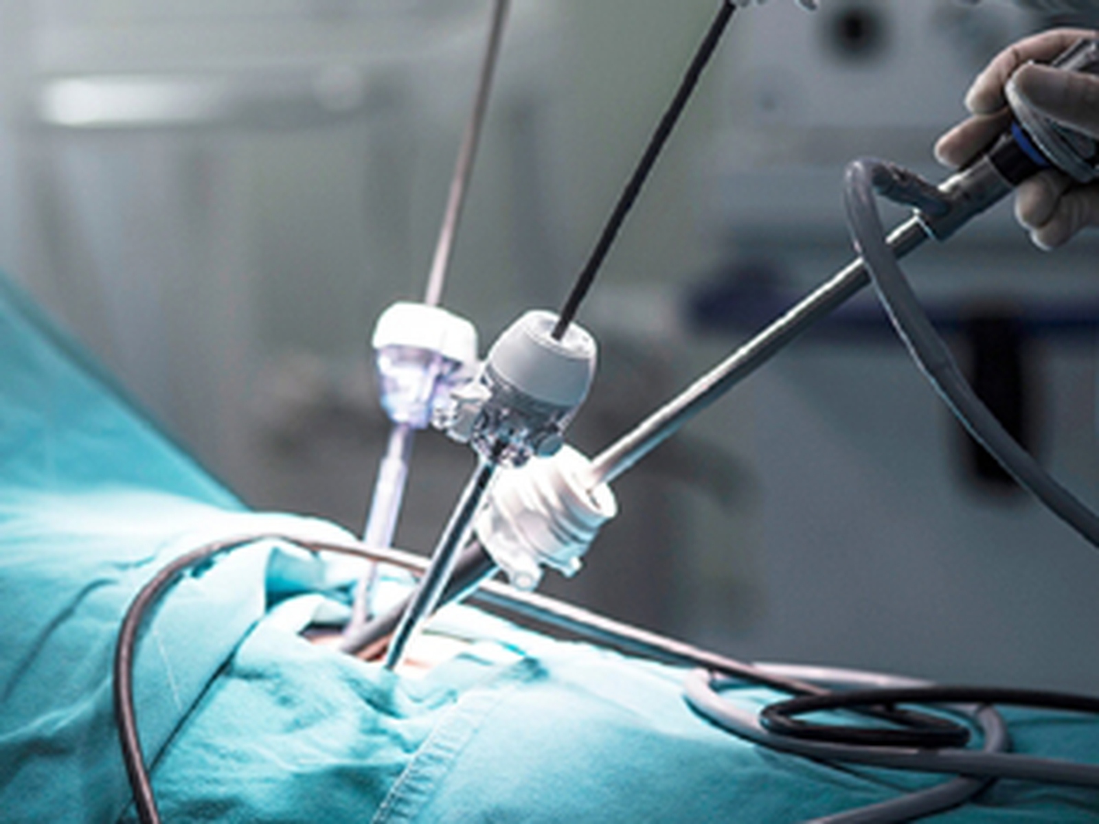 Laparoscopic Surgery